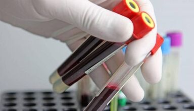 How to take a test for parasites in the body