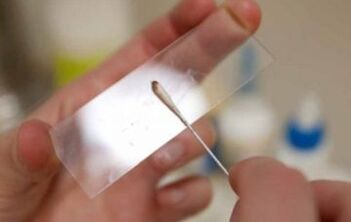 What tests should be taken on parasites
