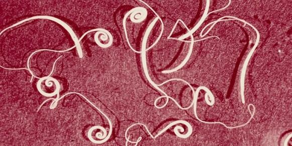 image of human parasites